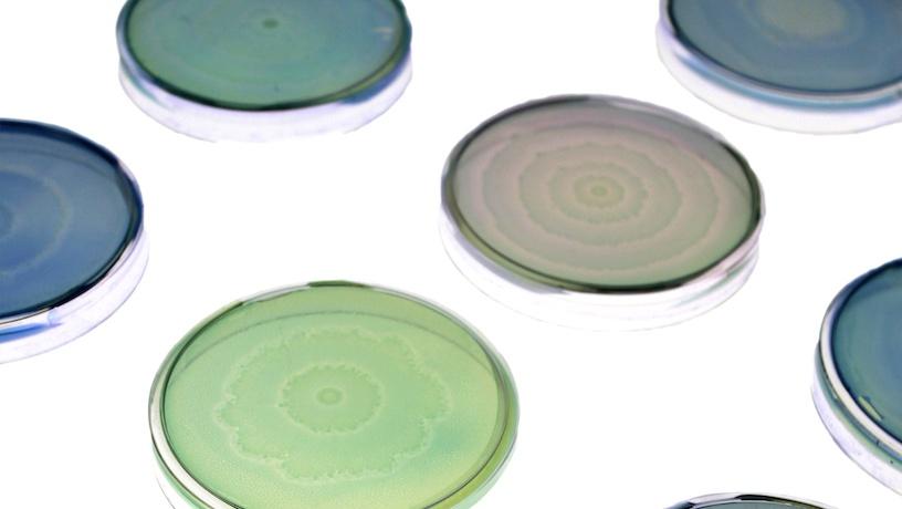 Petri dishes with different coloured dyes